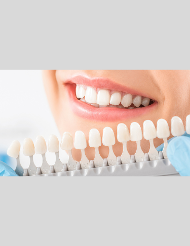 375px x 486px - Cosmetic Dentistry - Rama Dental